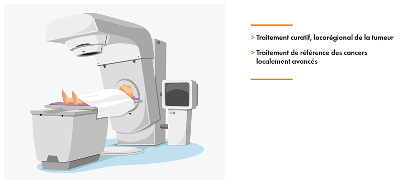 Radiothérapie externe