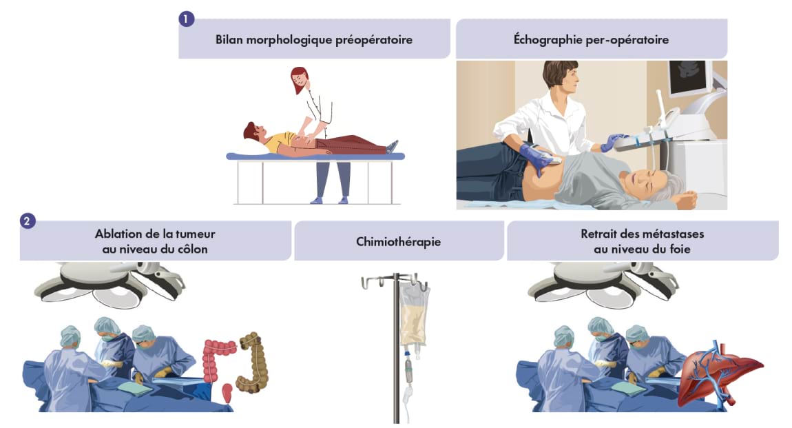Image Prise en charge