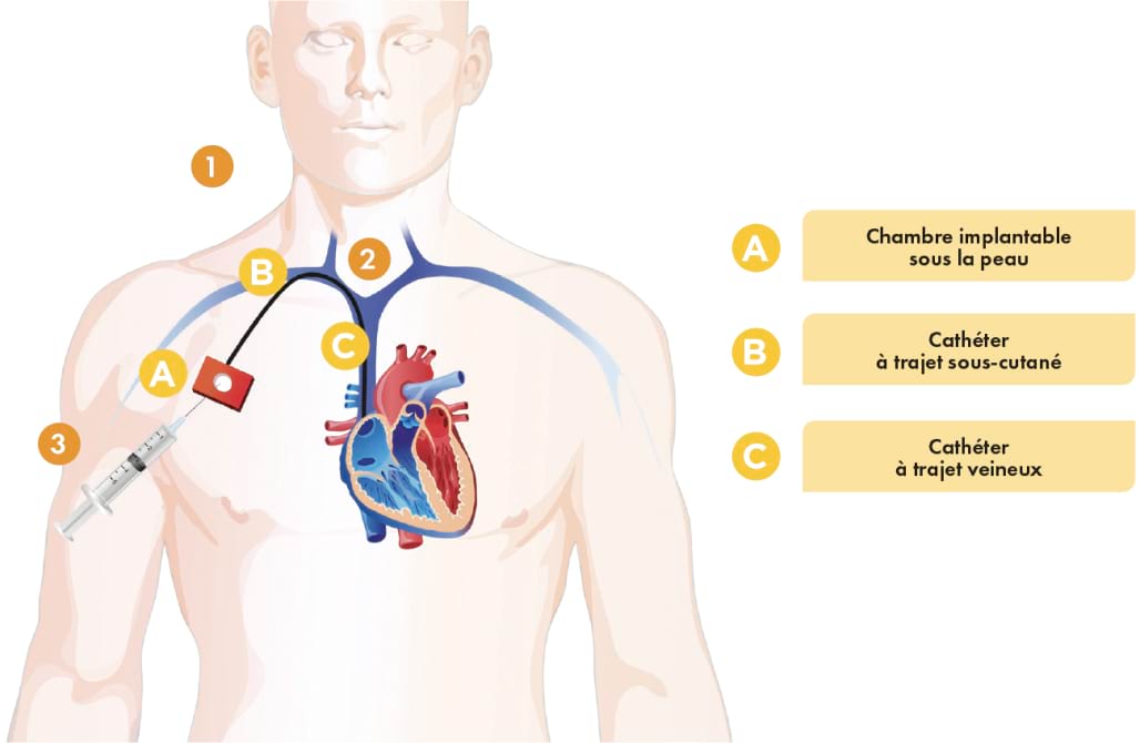 Image Prise en charge